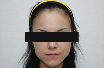 여성 헤어라인