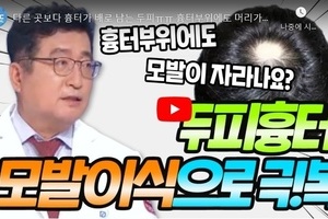 흉터 치료와 모발 이식