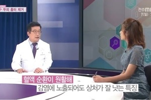 모발 이식에 의한 두피 흉터 제거