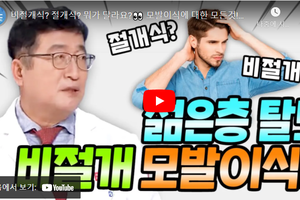 + 비절개 모발이식