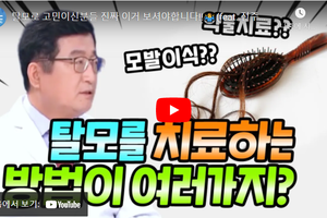 + 가발과 비절개 모발 이식.