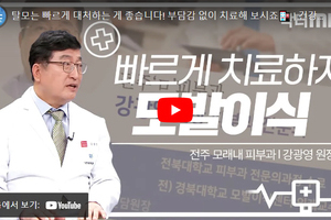 + 모발이식