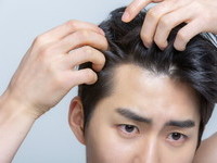 현대인의 스트레스 유발하는 탈모, 적
