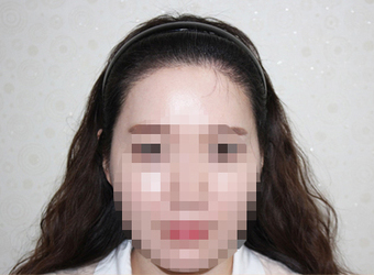시술 후 사진